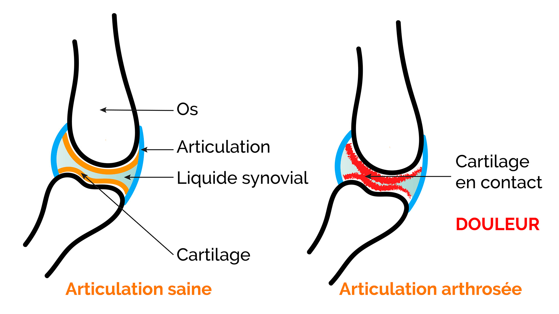 identifier-arthrose-cheval