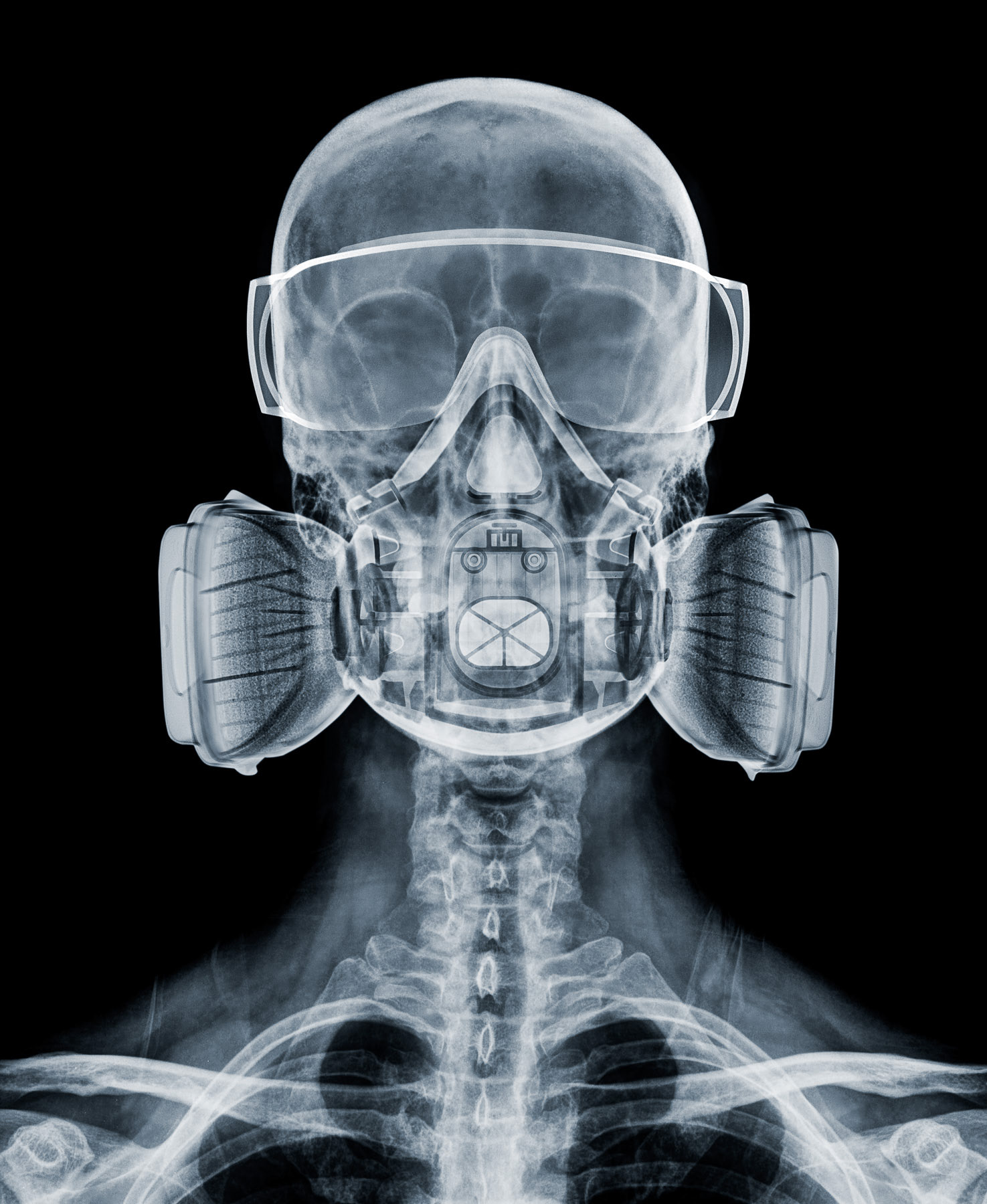 PPE