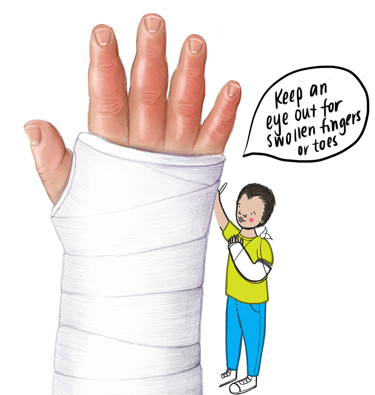 Emma Scheltema Illustration Cast Care Patient Education for Starship