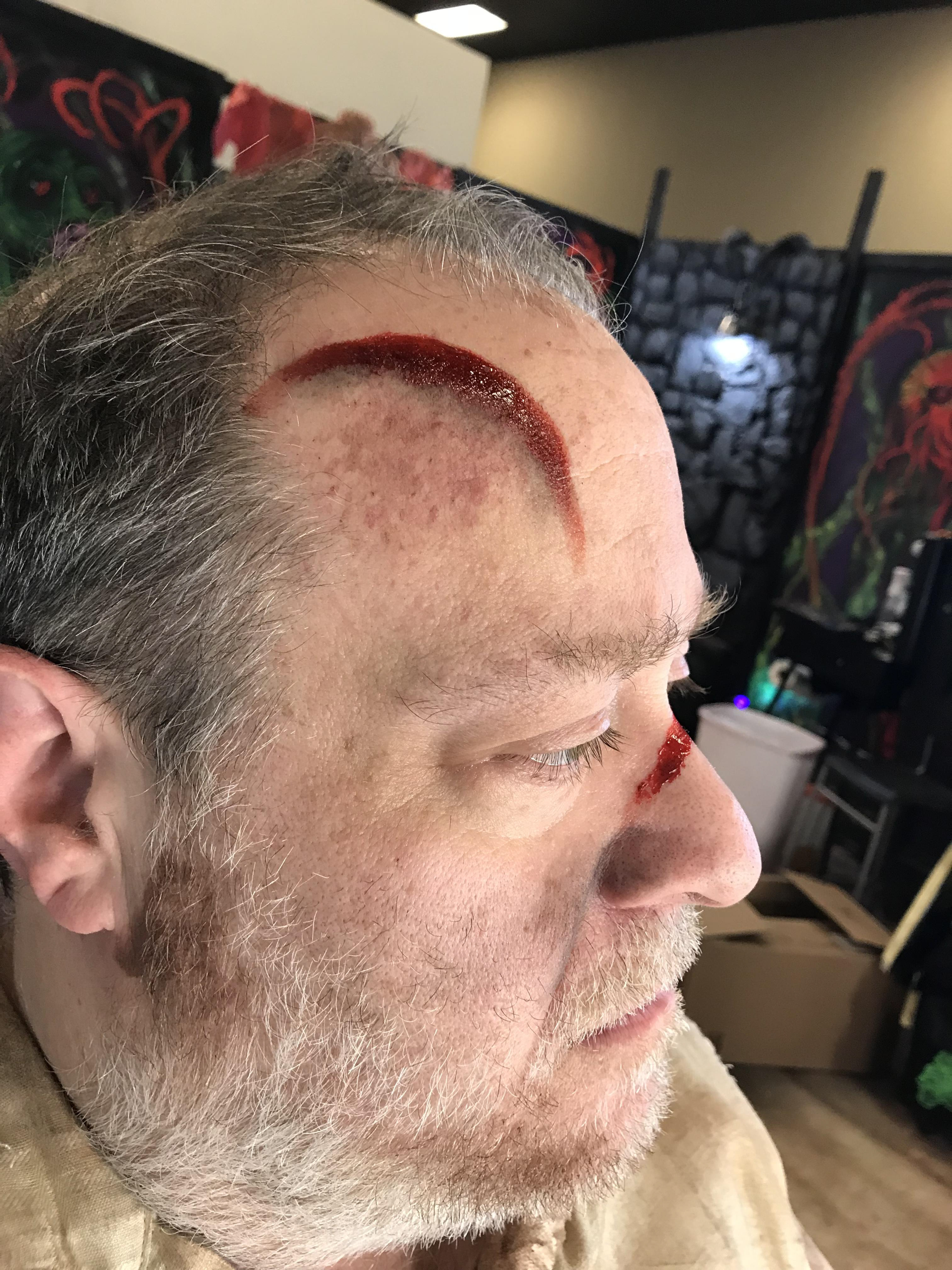 Kicked by horse