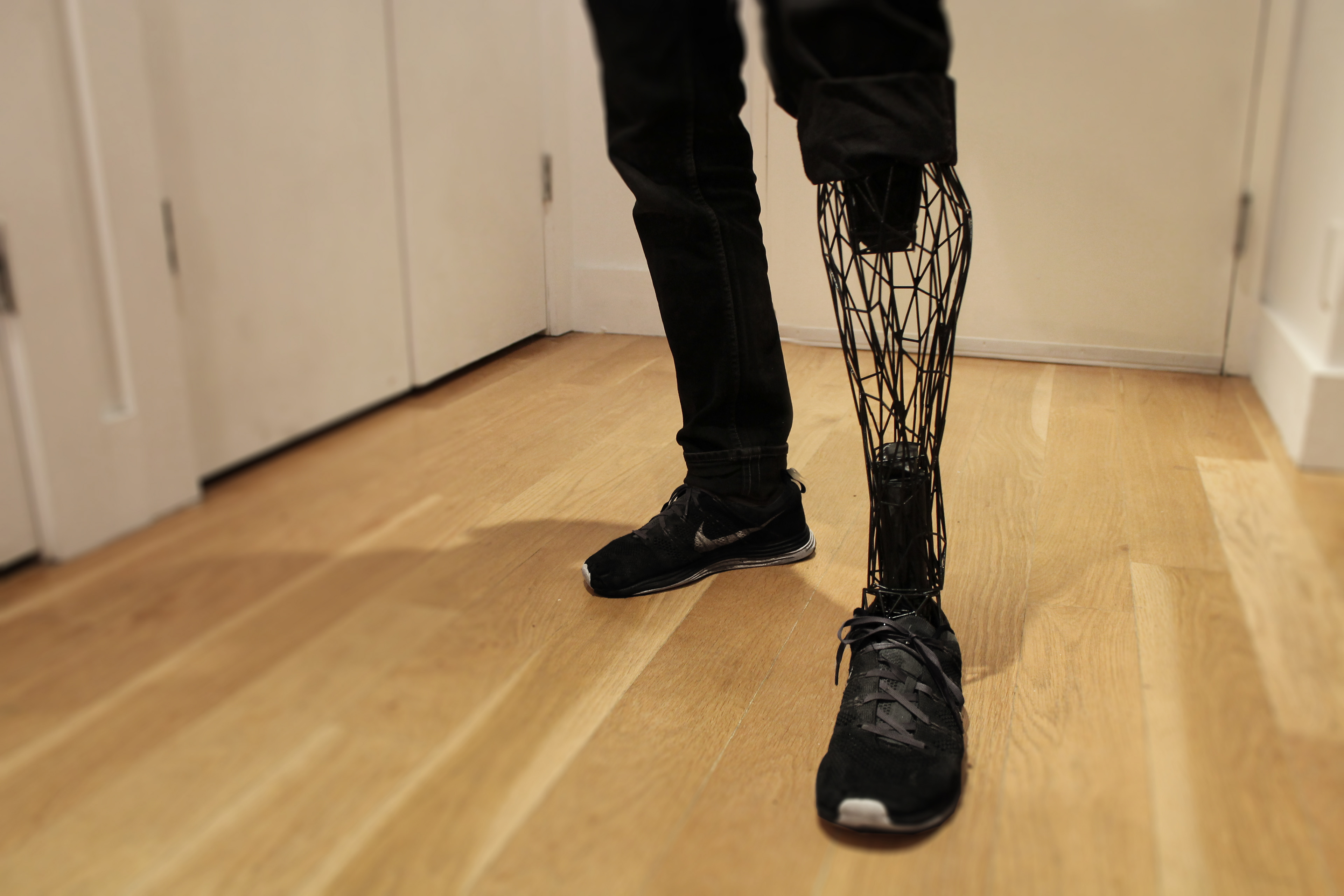 william-root-exo-prosthetic-leg