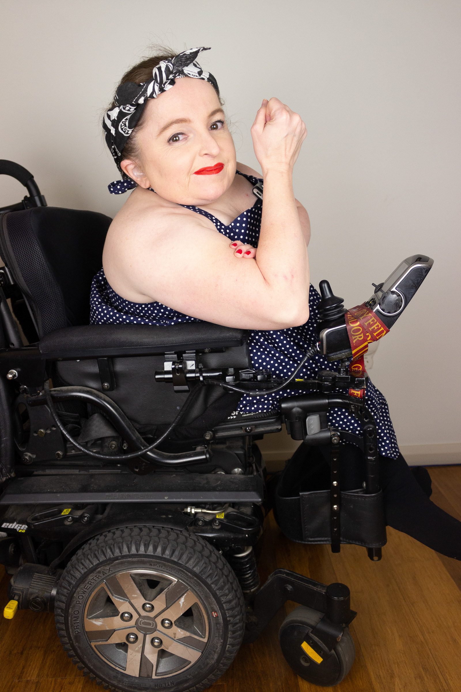 Mel in a black polka dot dress, headband, making a fist while sitting in her wheelchair