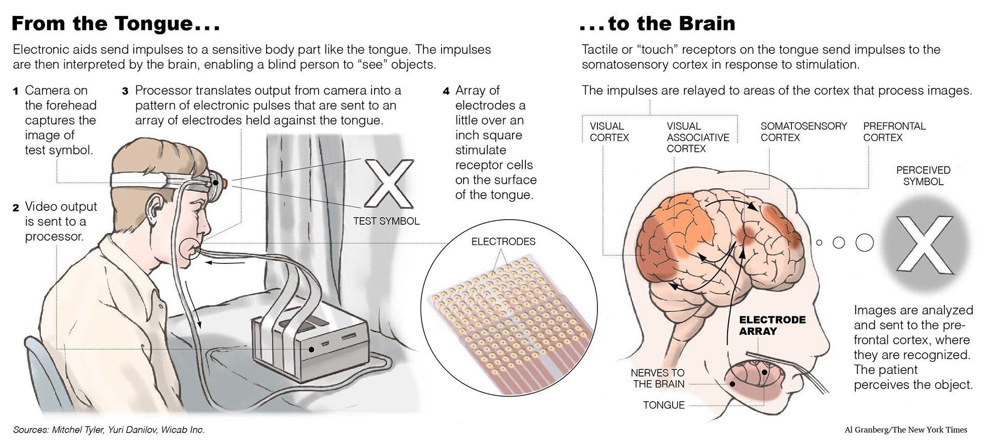 Illustration of a method of sending impulses from a device to stimulate nerves, whose signals are interpreted by the brain, enabling a blind patient to see. For The New York Times.